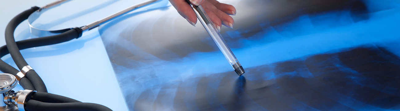 asbestos disease scan mri