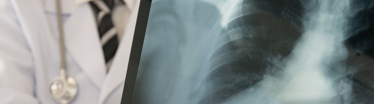 doctor looking at x-ray